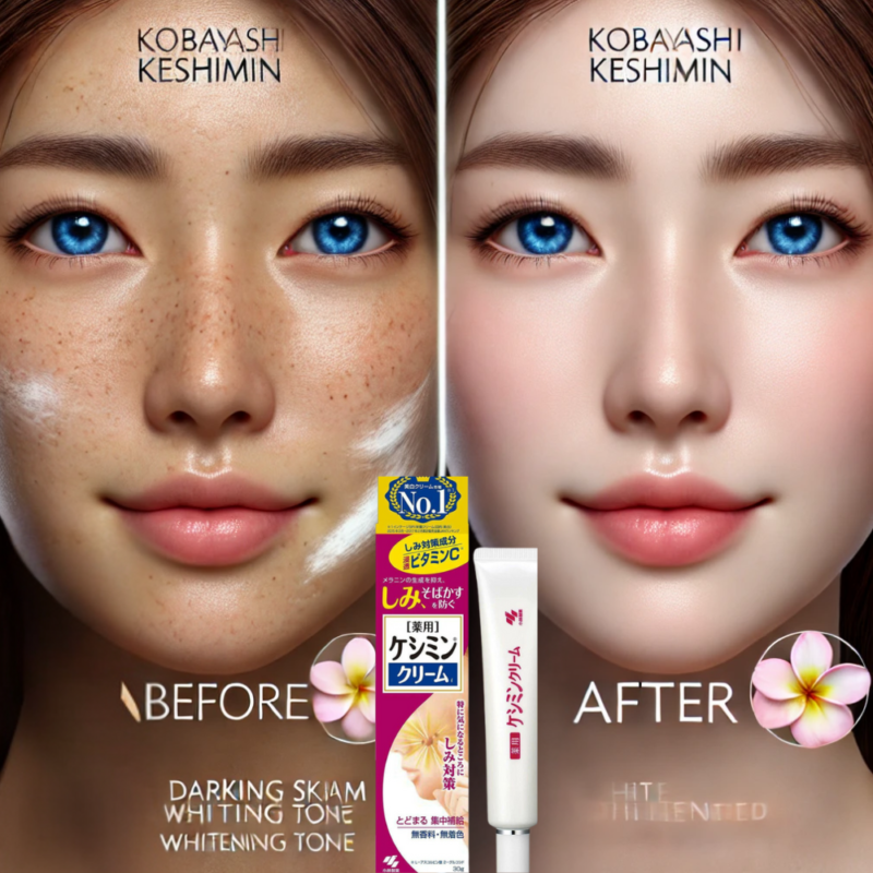 Visualize the Transformation with Kobayashi Keshimin Whitening Cream (Medicated)