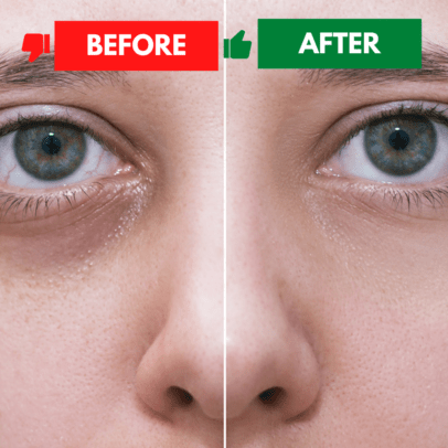 Before & After Transformation with Sana Nameraka Wrinkle Care Eye Cream........