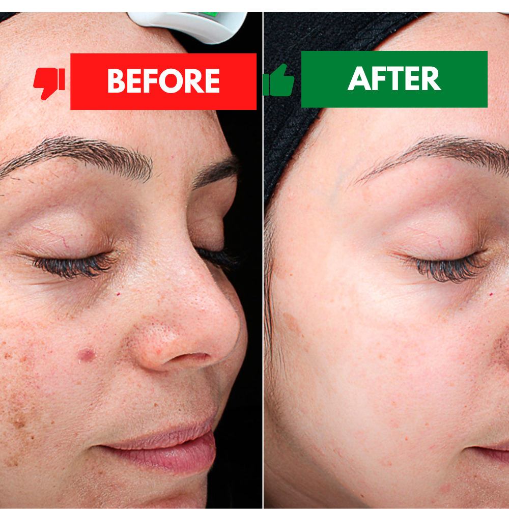 Visual Transformation with Nivea Skin Milk – Smooth & Moist